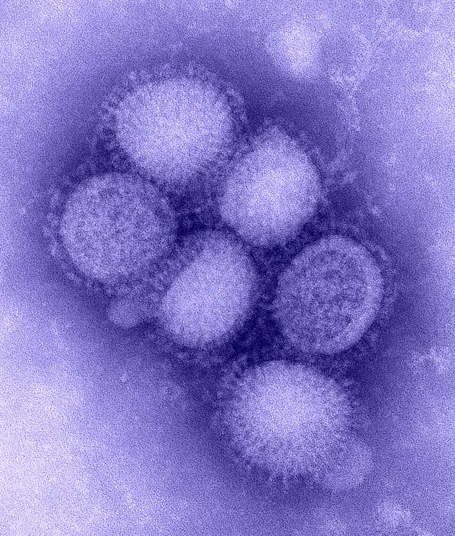 swine_flu.jpg