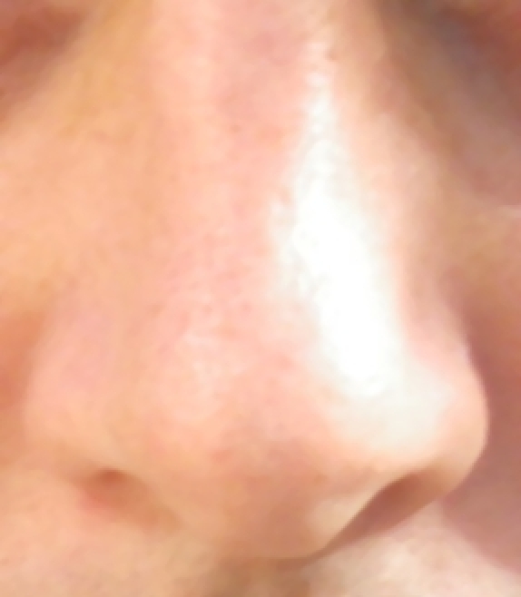 nose.jpg