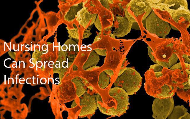 komplikasi asbestosis meliputi penyakit